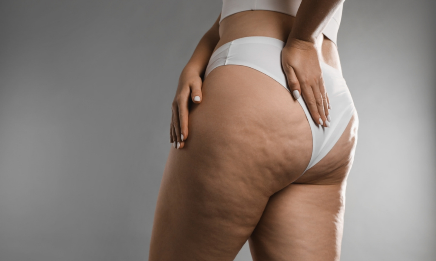 Tratamento do Lipedema, Dr. Davi Heckmann